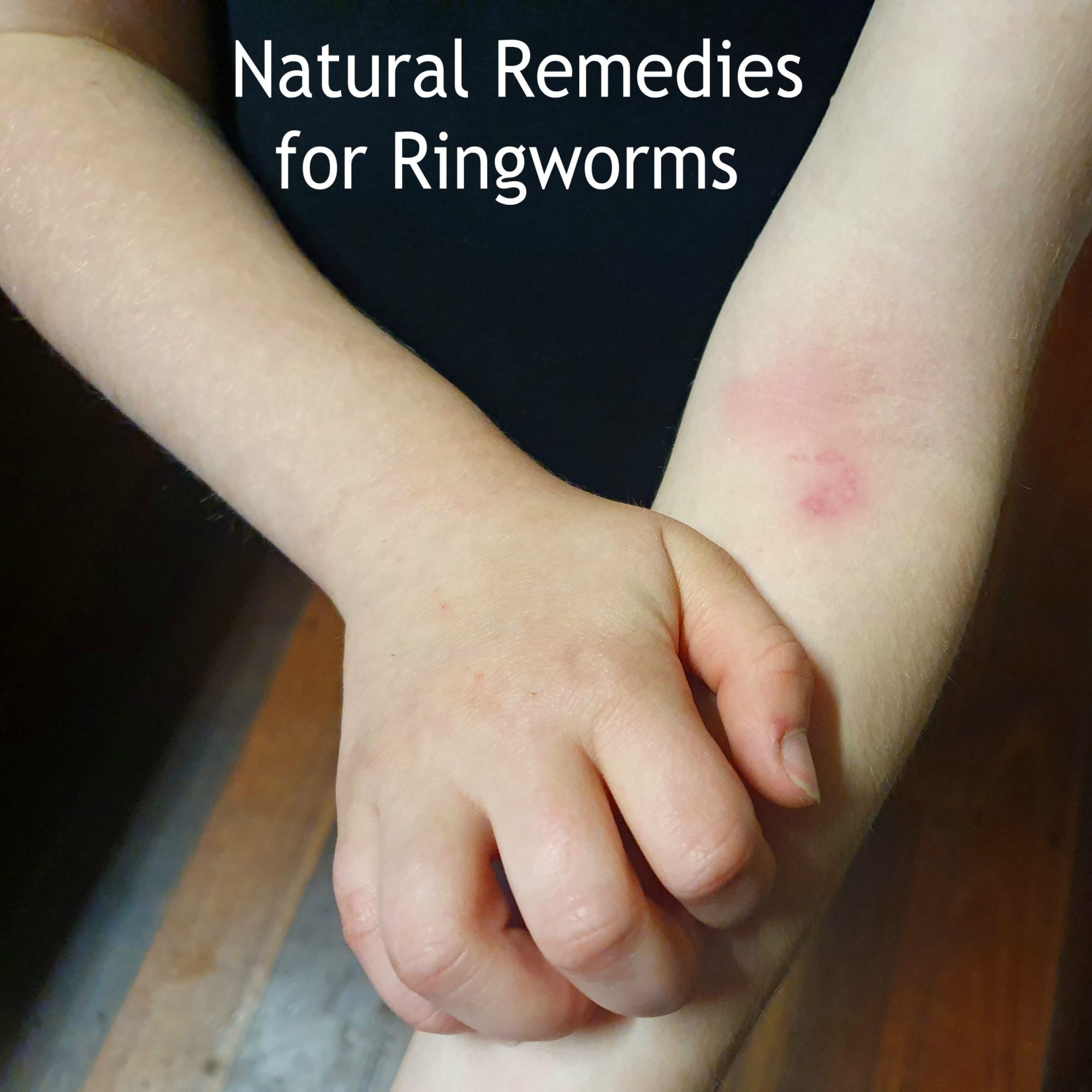 how to get rid of ringworm in humans